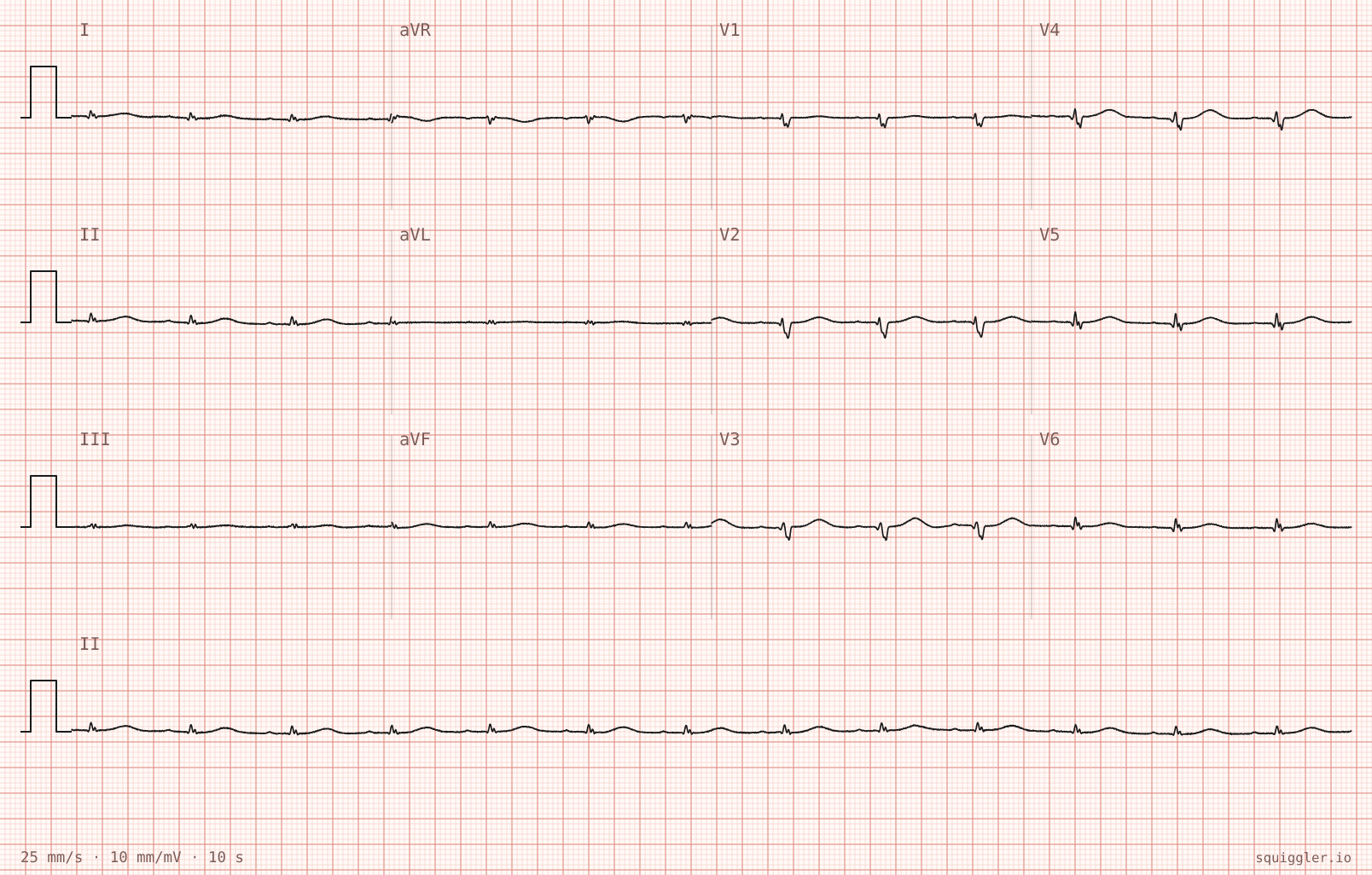 The tracing for the quiz “Breathlessness climbing stairs, worsening over six months, with ankle swelling”.