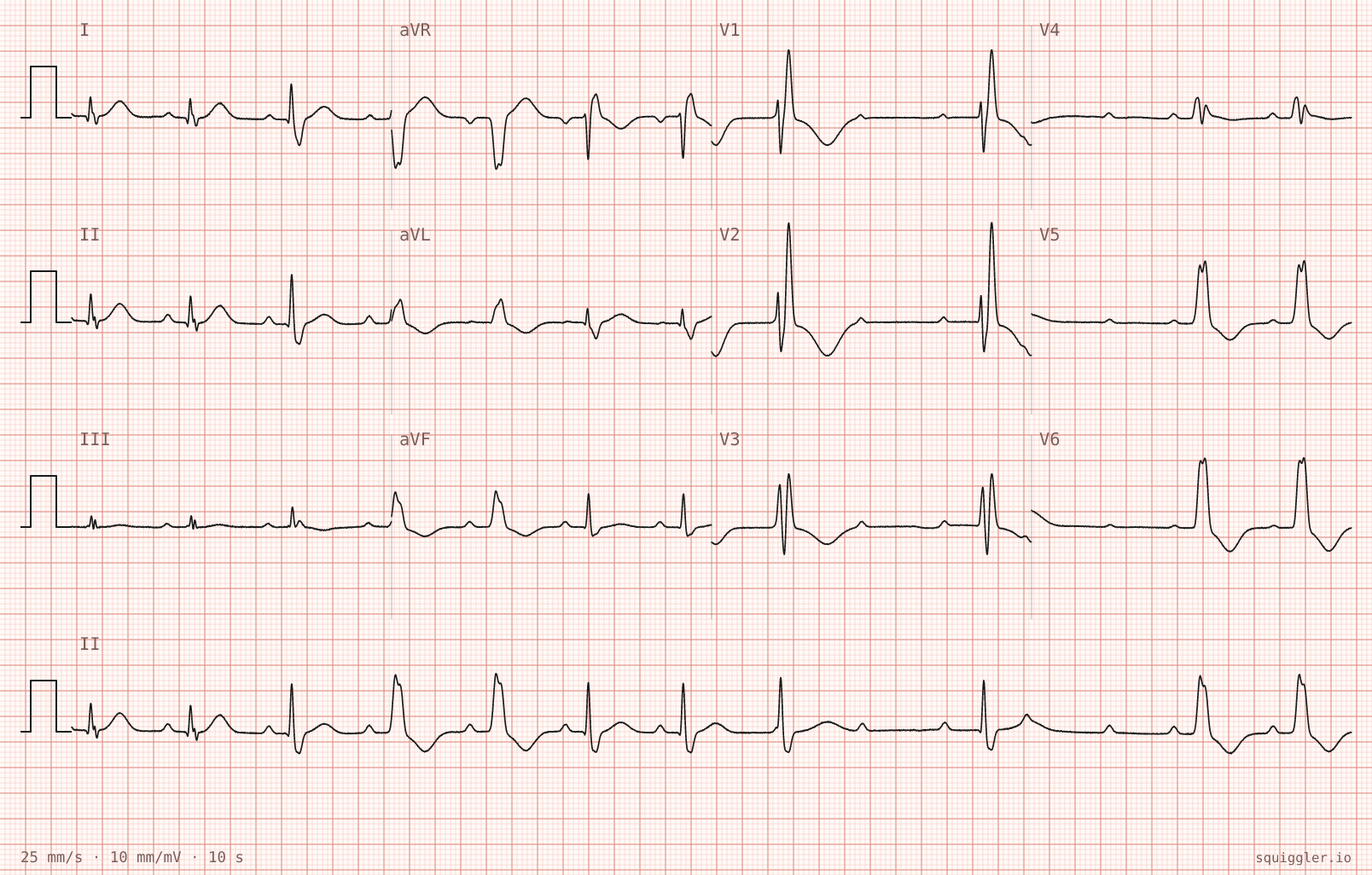 Tracing 1 of 2 for the quiz “Dizziness and two near-faints since this morning”.