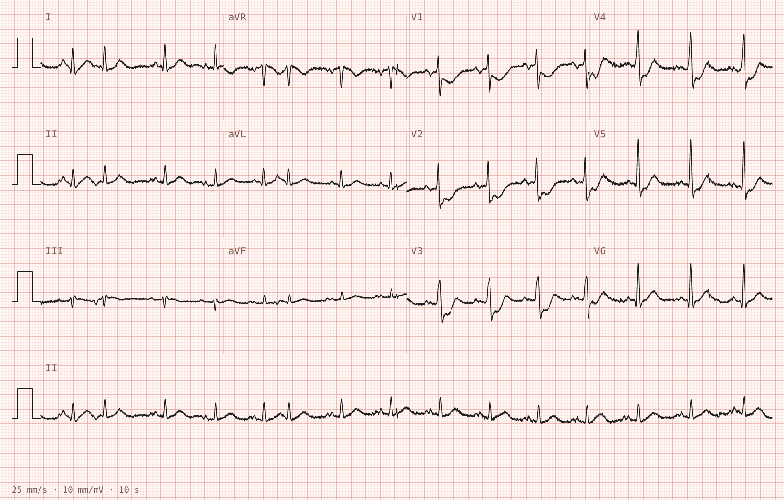 Tracing 1 of 2 for the quiz “Epigastric pressure and nausea for four hours”.