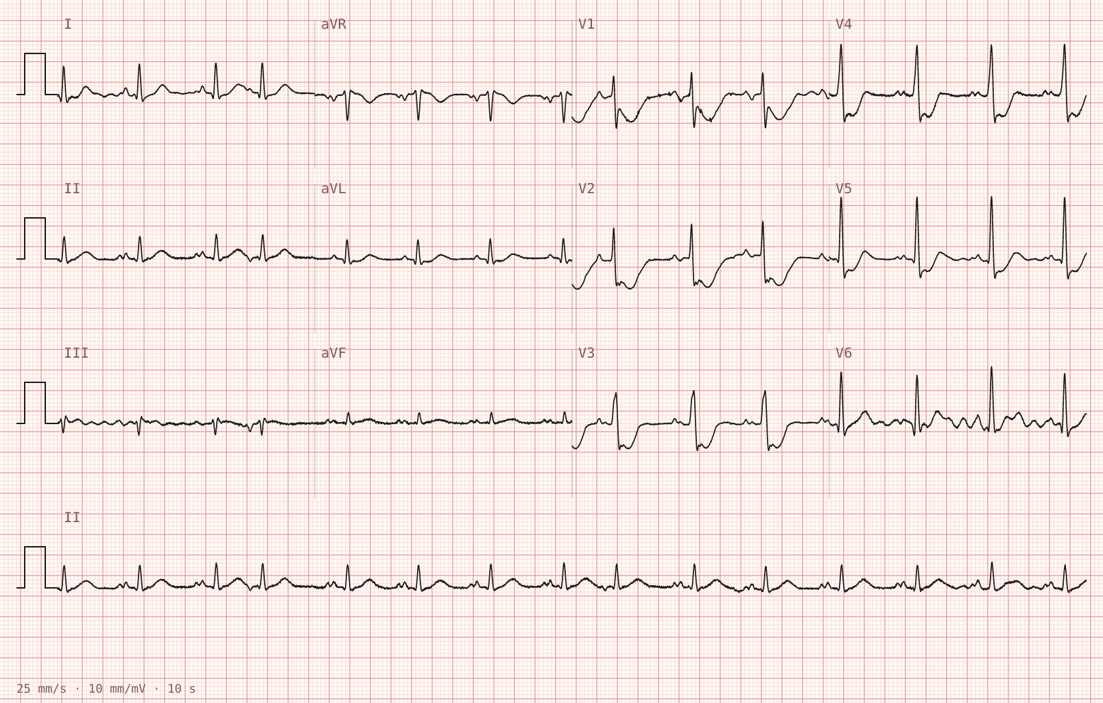 Tracing 2 of 2 for the quiz “Epigastric pressure and nausea for four hours”.