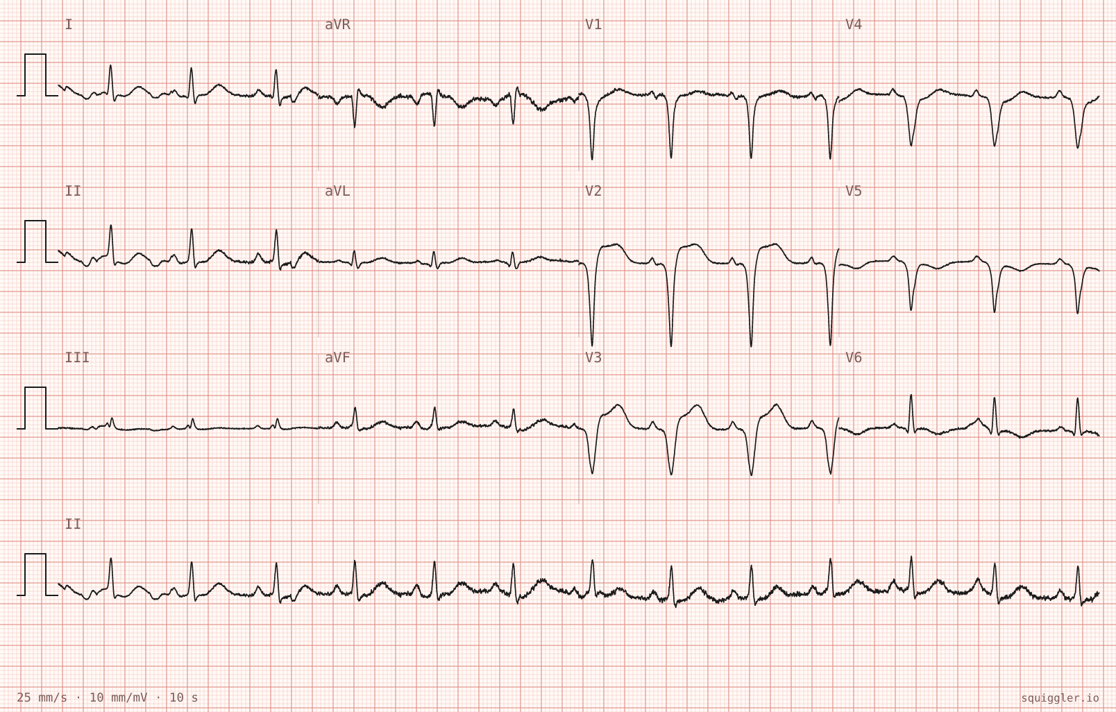 Tracing 2 of 2 for the quiz “Indigestion”.