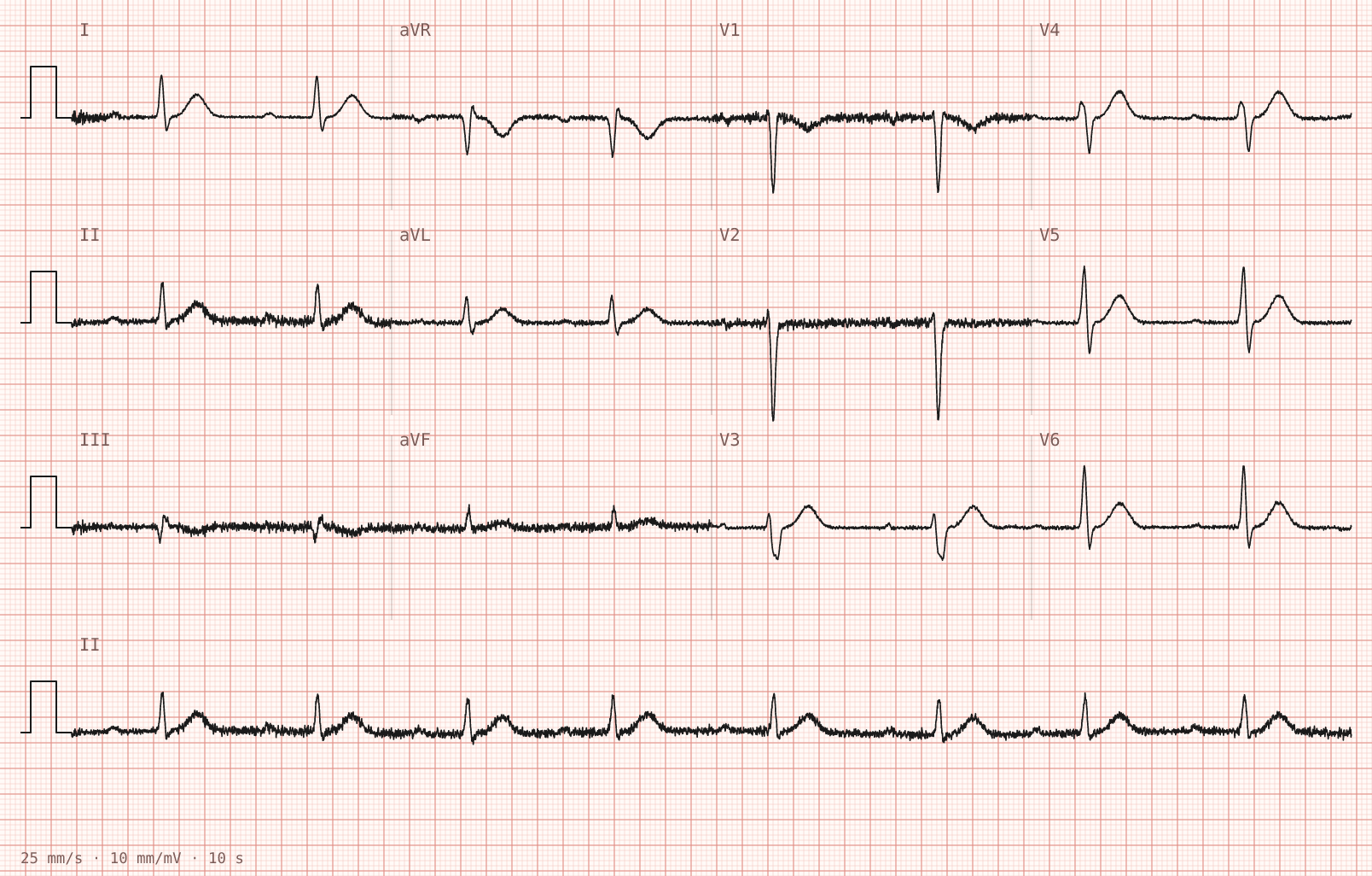Tracing 1 of 2 for the quiz “Lightheadedness and palpitations for three days”.