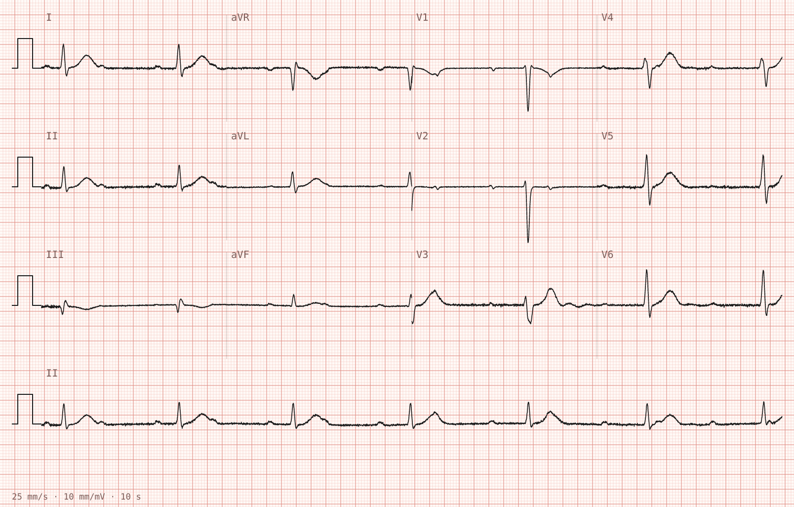 Tracing 2 of 2 for the quiz “Lightheadedness and palpitations for three days”.