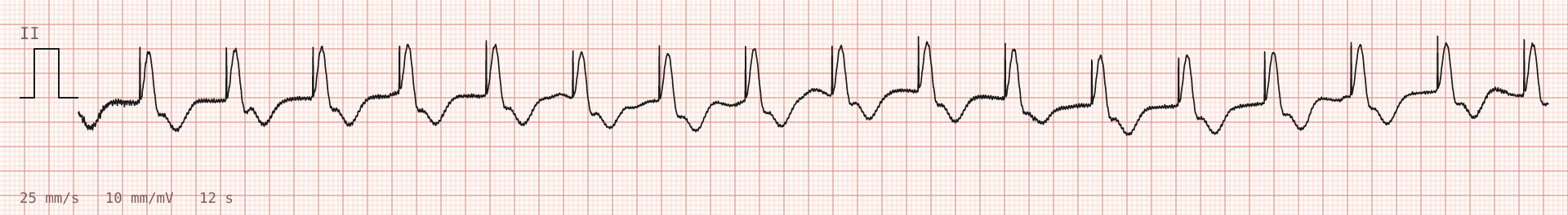 Tracing 2 of 2 for the quiz “Monitor alarm during a laparoscopic operation”.