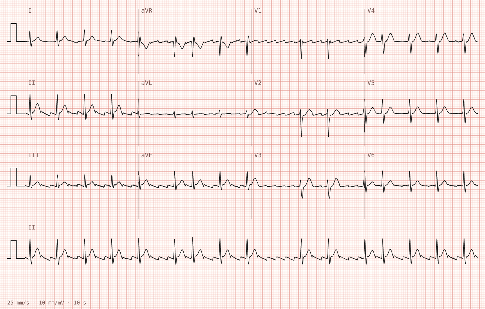 Tracing 1 of 2 for the quiz “Palpitations for three weeks, worse over the last two days”.
