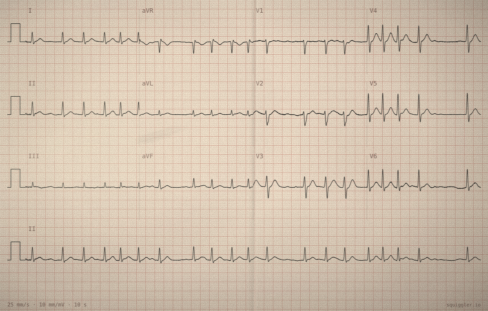 Tracing 1 of 2 for the quiz “Racing heart walking up the hill”.