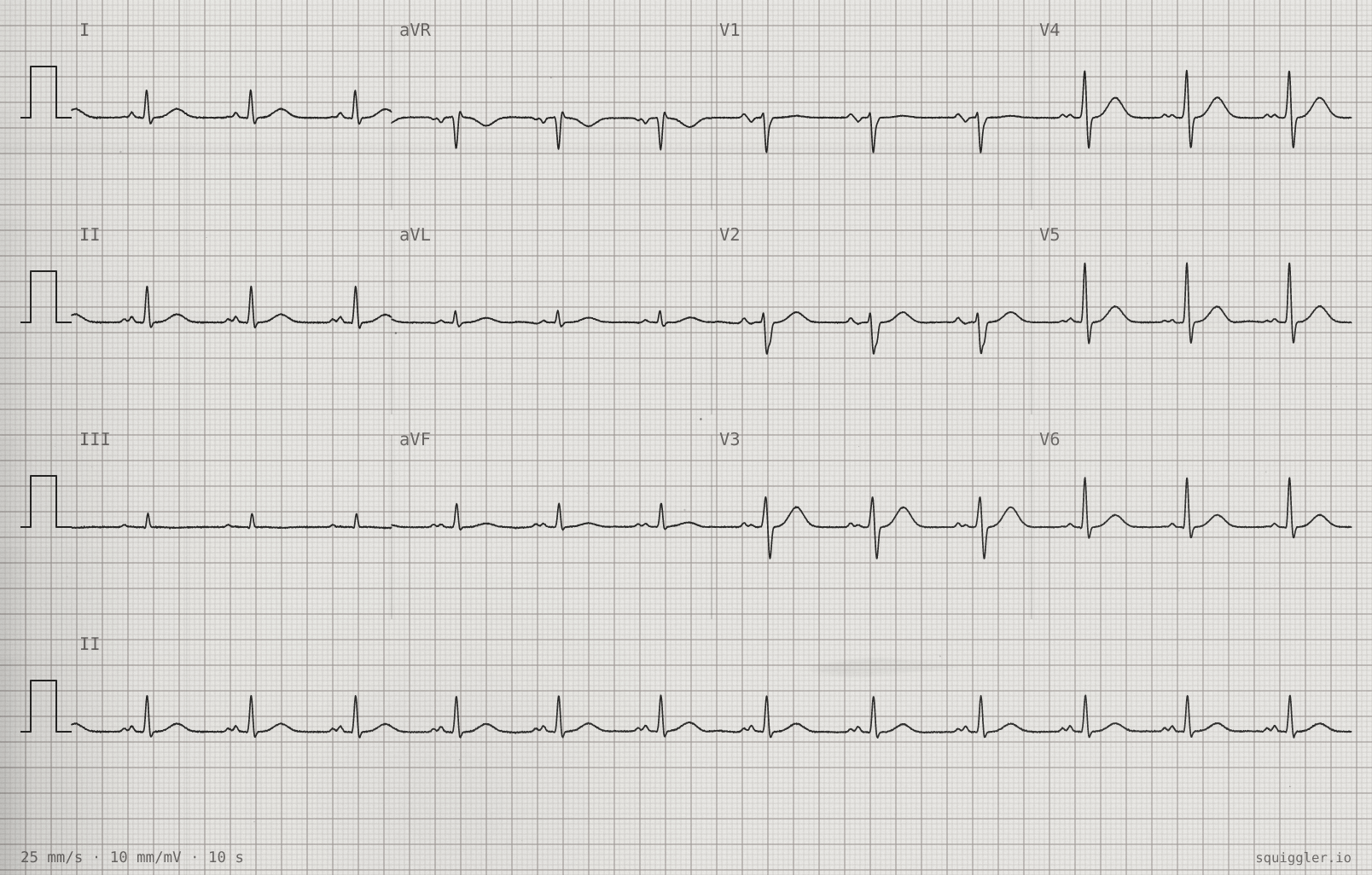 Tracing 2 of 2 for the quiz “Racing heart walking up the hill”.