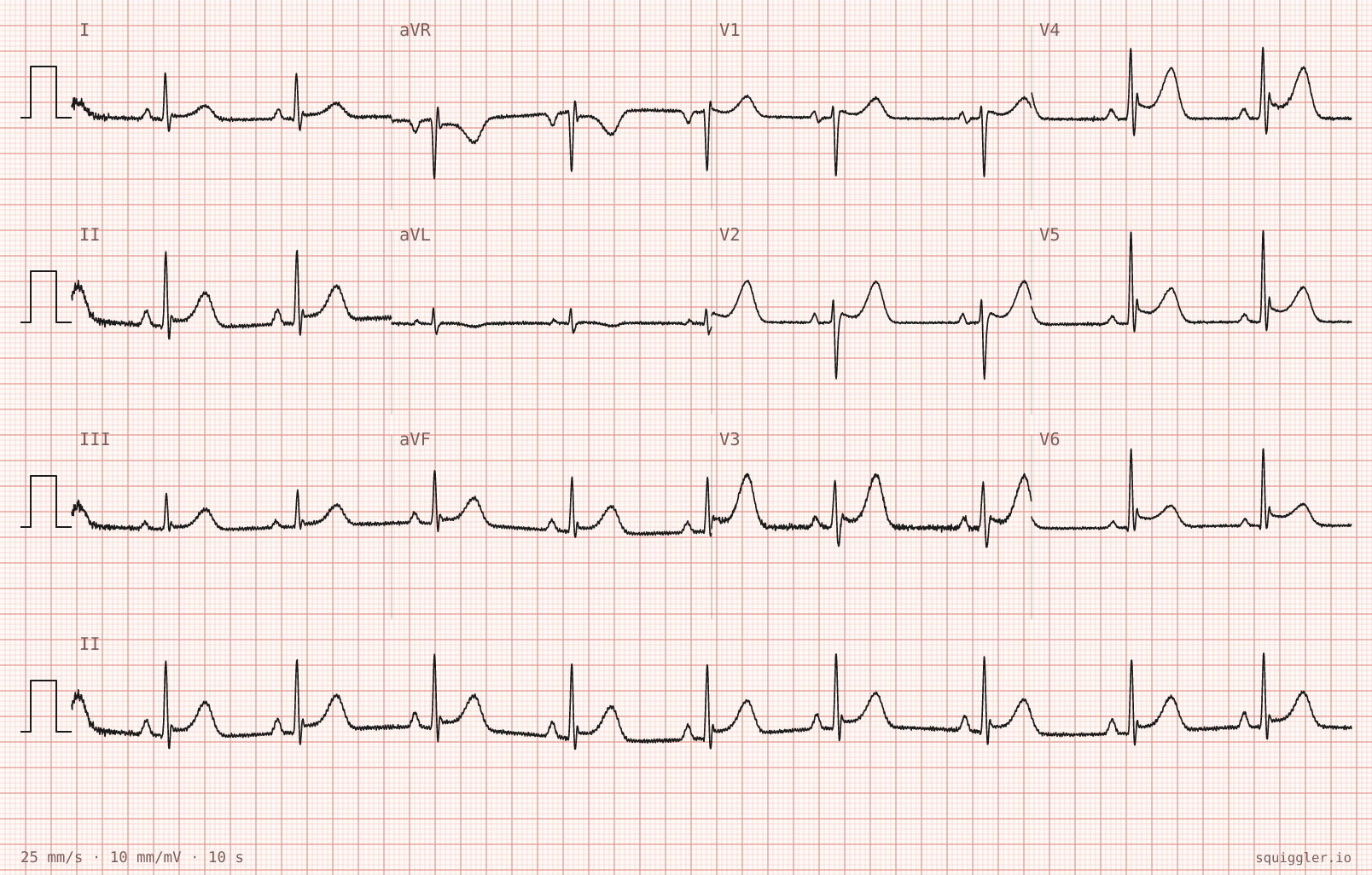 Tracing 1 of 2 for the quiz “Sharp pain under my left ribs since moving a sofa”.
