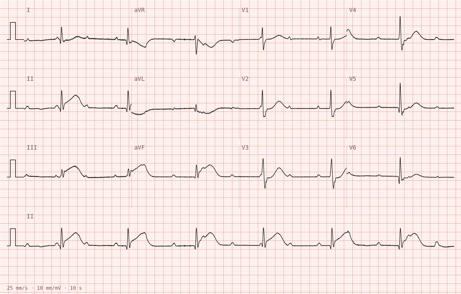 Tracing 1 of 2 for the quiz “Vomiting and clamminess for an hour, with a heavy feeling across the chest”.