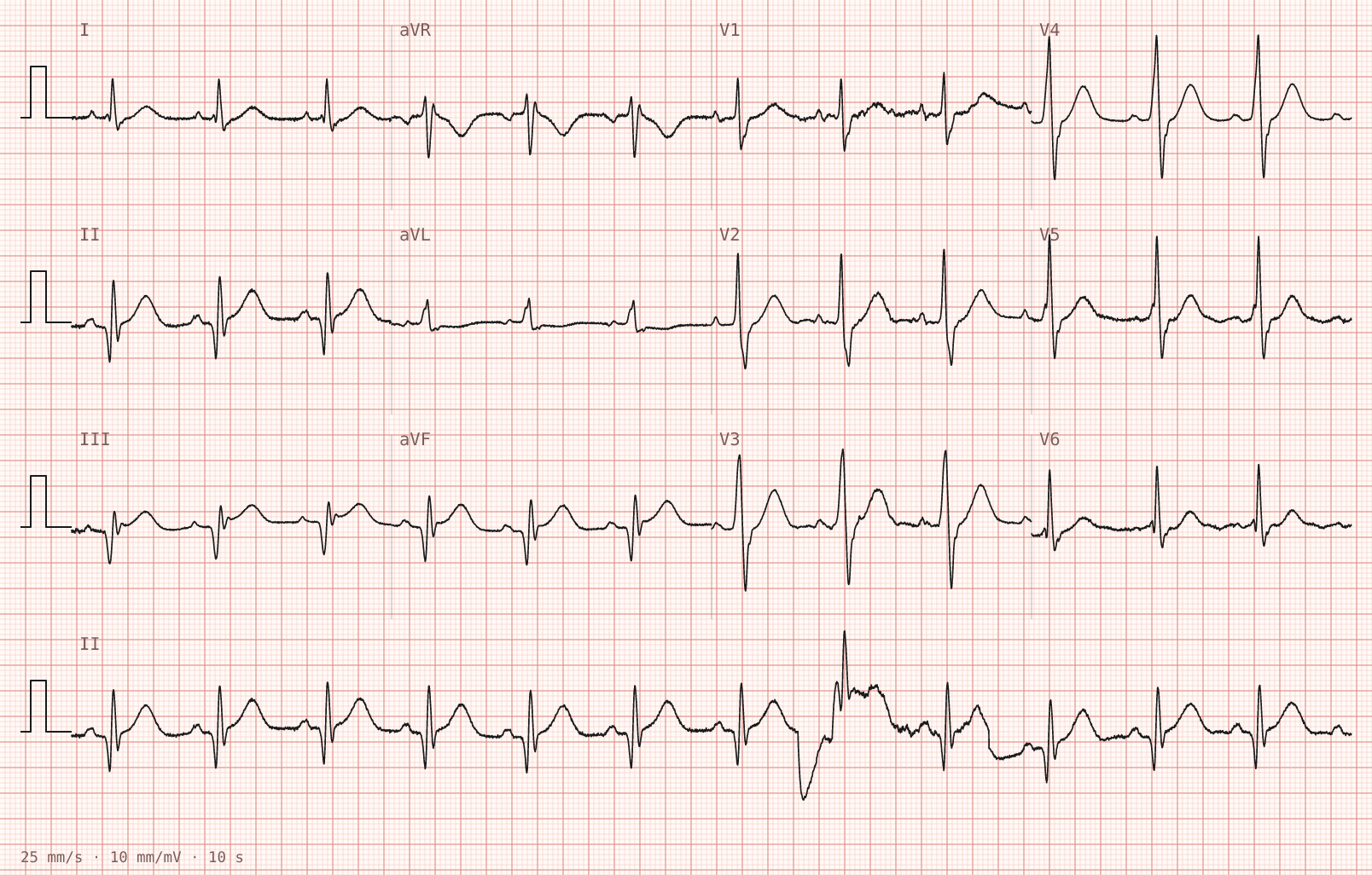 Tracing 2 of 2 for the quiz “Vomiting and clamminess for an hour, with a heavy feeling across the chest”.
