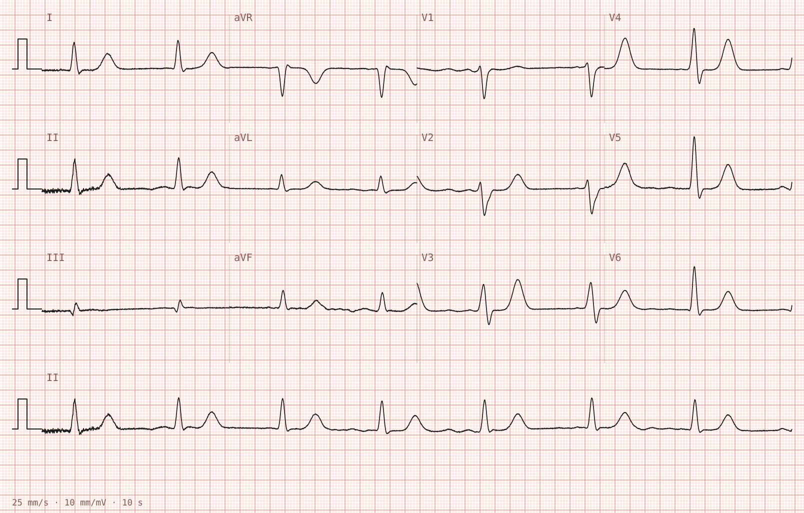 Tracing 1 of 2 for the quiz “Weakness and vomiting for three days”.