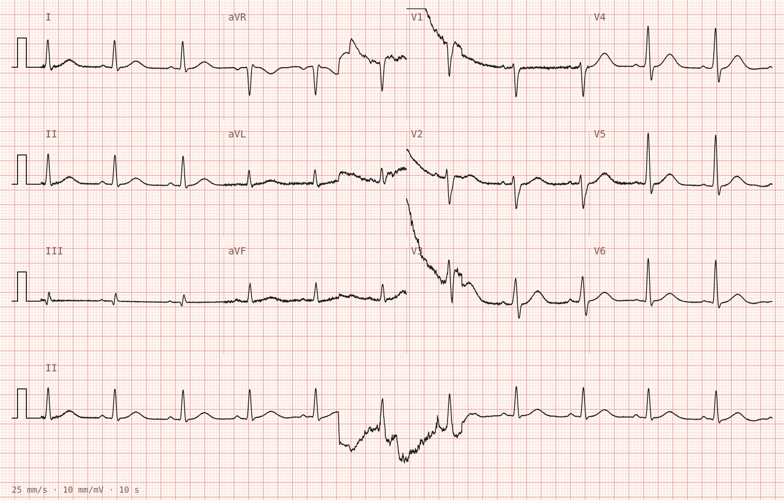 Tracing 2 of 2 for the quiz “Weakness and vomiting for three days”.
