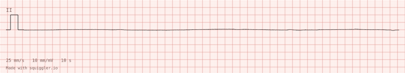 Asystole — synthetic ECG on millimetre paper